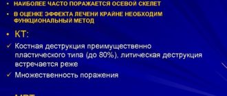 Обезболивающее при раке предстательной железы и метостазах