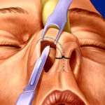 Гистология слизистой носа