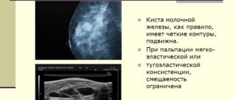 Образование в молочной железе