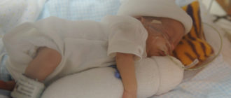 Гипотрофия плода