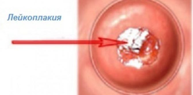 Онкоцитология и лейкоплакия