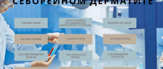 Перечень анализов для определения сухой себореи