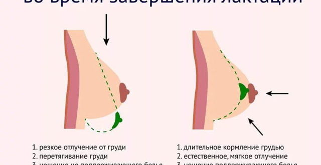 Грудь при завершении ГВ