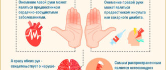 Немеют ладони после сна