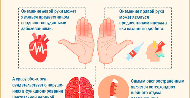 Немеют ладони после сна