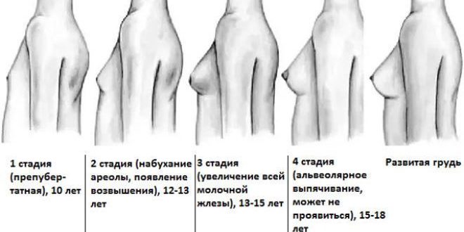 Не сформированная форма в груди в 20 лет