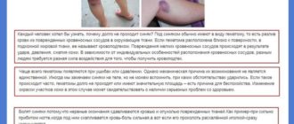Не проходит синяк долго