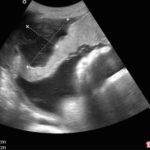 Горечь и жжение во рту