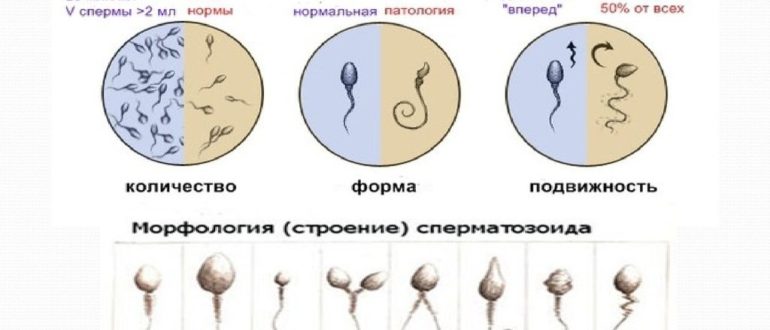 Низкий процент спермы, спермотренд