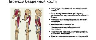 Перелом бедренной кости, осложнение, сроки госпитализации