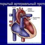 Гной из глаза после наращивания ресниц