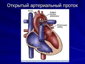 Функционирующий оап