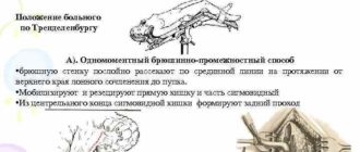 Операция на прямой кишке-онкология