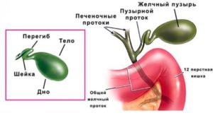 Перегиб желчного пузыря, признаки панкреатита, поверхностный гастрит