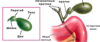 Перегиб желчного пузыря, признаки панкреатита, поверхностный гастрит