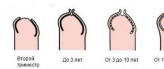 Не полностью открывается писюн