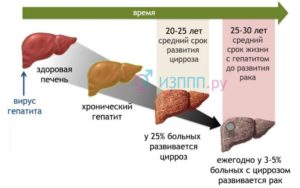 Гепатит С продолжительность 25 лет