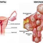 Гистология плаценты