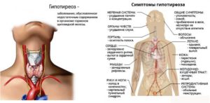 Омега 3 при гипотериозе щитовидной железы