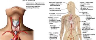 Омега 3 при гипотериозе щитовидной железы