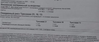 Носовая косточка плода на нижней границе нормы