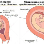 Гипоплазия яичек