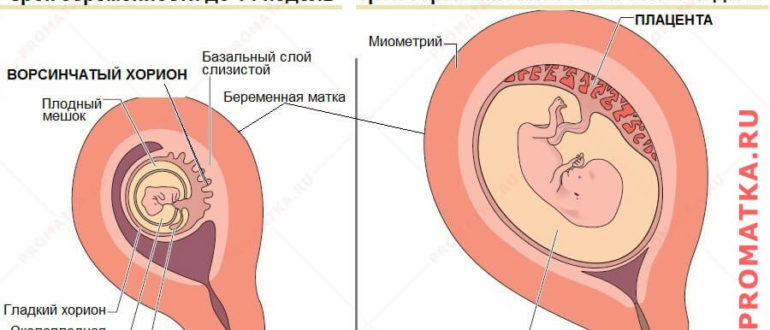 Остатки плацентарного полипа или рубцовые изменения, возможность забеременеть