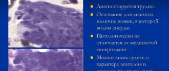 Фрагменты железистого полипа