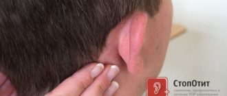 Головная боль несколько месяцев, появилась опухоль возле уха