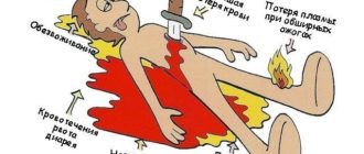Гиповолемия щитовидной железы