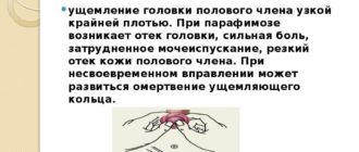 Опухла крайняя плоть головки