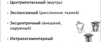 Определяется ли размер узла при центрипетальном росте?
