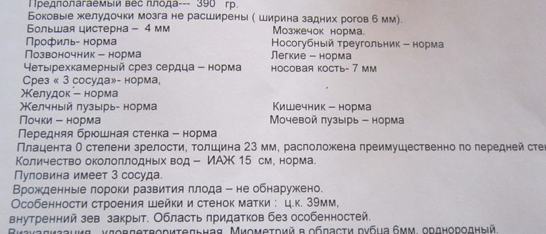 Осмотр сердца плода, расшифровка УЗИ