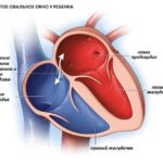 Отчетливо ощущаю сердцебиение, часто повышается пульс 90-120 и иногда АД