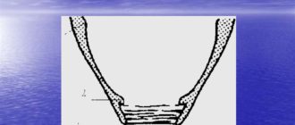 Открыт всегда внешний зев