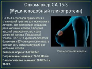 Онкомаркер молочной железы СА 15.3