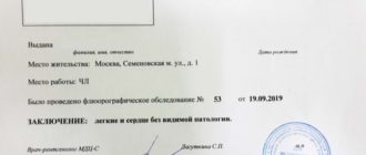 Флюрография заключение