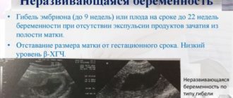 Неразвивающаяся беременность на 8 неделе