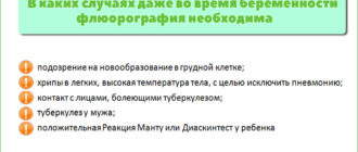 Флюорография мужа при планировании беременности