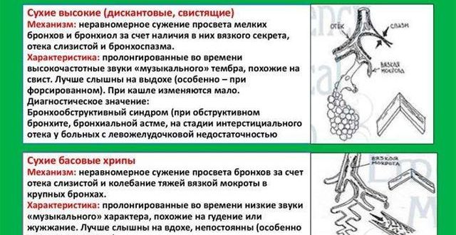 Хрипы в бронхах или легких