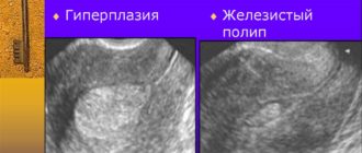 Патология эндометрия