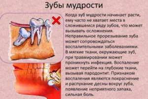 Не определить какой зуб болит