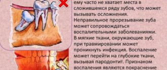 Не определить какой зуб болит