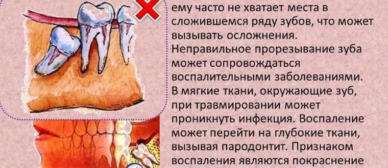 Не определить какой зуб болит