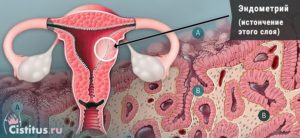 Гипоплазия эндометрия и беременность
