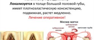 Опухла половая губа