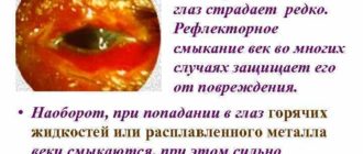 Ожог глаза паром