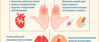 Немеет левая рука иногда лицо