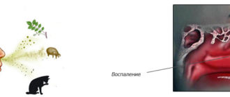 Непроходящий отек слизистой носа и слезящийся глаз