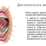 Образование в носоглотке